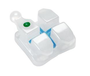 牙齿矫正,牙套如何选择 隐形 金属 陶瓷