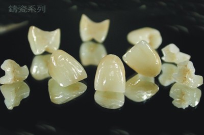 台湾定远陶齿制品 工艺与美学的完美融合